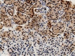 AK5 Monoclonal Antibody (OTI2F9), TrueMAB , OriGene 100 &mu;L; Unconjugated:Antibodies,