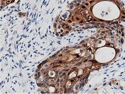 AK5 Monoclonal Antibody (OTI2F9), TrueMAB , OriGene 100 &mu;L; Unconjugated:Antibodies,