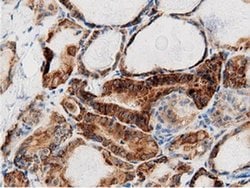 AK5 Monoclonal Antibody (OTI2F9), TrueMAB , OriGene 100 &mu;L; Unconjugated:Antibodies,