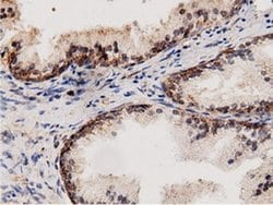 AK5 Monoclonal Antibody (OTI2F9), TrueMAB , OriGene 100 &mu;L; Unconjugated:Antibodies,