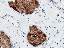 AK5 Monoclonal Antibody (OTI2F9), TrueMAB , OriGene 100 &mu;L; Unconjugated:Antibodies,