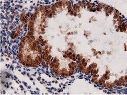 AK5 Monoclonal Antibody (OTI2F9), TrueMAB , OriGene 100 &mu;L; Unconjugated:Antibodies,