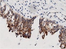 AK5 Monoclonal Antibody (OTI2F9), TrueMAB , OriGene 100 &mu;L; Unconjugated:Antibodies,