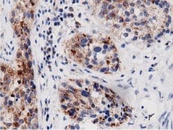 AK5 Monoclonal Antibody (OTI2F9), TrueMAB , OriGene 100 &mu;L; Unconjugated:Antibodies,