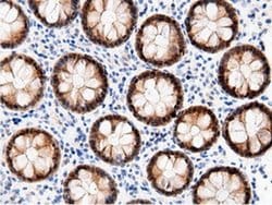 AK5 Monoclonal Antibody (OTI2F9), TrueMAB , OriGene 100 &mu;L; Unconjugated:Antibodies,