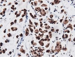 AK5 Monoclonal Antibody (OTI2F9), TrueMAB , OriGene 100 &mu;L; Unconjugated:Antibodies,
