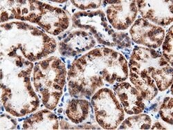 AK5 Monoclonal Antibody (OTI2F9), TrueMAB , OriGene 100 &mu;L; Unconjugated:Antibodies,