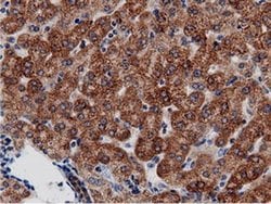 AK5 Monoclonal Antibody (OTI2F9), TrueMAB , OriGene 100 &mu;L; Unconjugated:Antibodies,