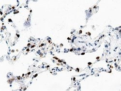 AK5 Monoclonal Antibody (OTI2F9), TrueMAB , OriGene 100 &mu;L; Unconjugated:Antibodies,