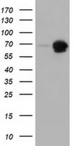 AK5 Monoclonal Antibody (OTI1D6), TrueMAB , OriGene 100 &mu;L; Unconjugated:Antibodies,