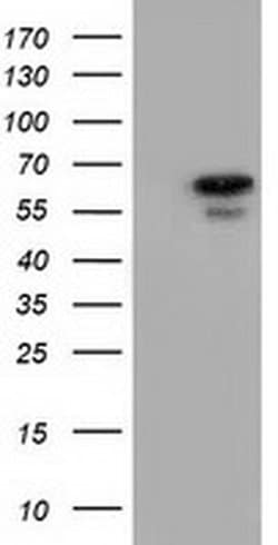 AK5 Monoclonal Antibody (OTI2A2), TrueMAB , OriGene 100 &mu;L; Unconjugated:Antibodies,