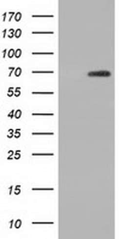 AK5 Monoclonal Antibody (OTI2A6), TrueMAB , OriGene 30 &mu;L | Buy Online | OriGene | Fisher Scientific