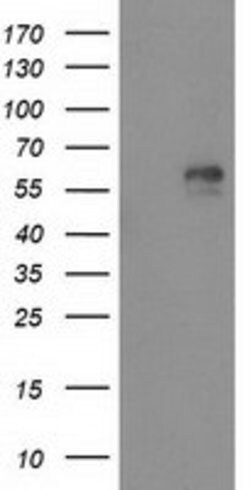 AK5 Mouse anti-Human, Clone: OTI1G3, lyophilized, TrueMAB 100 &mu;g; Unconjugated:Antibodies,