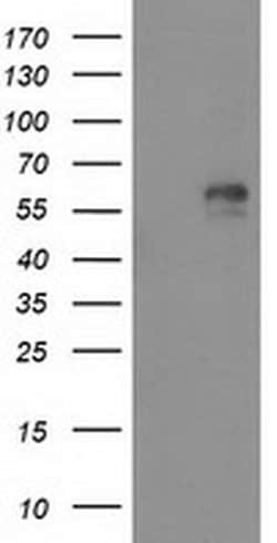 AK5 Monoclonal Antibody (OTI1G3), TrueMAB , OriGene 100 &mu;L; Unconjugated:Antibodies,