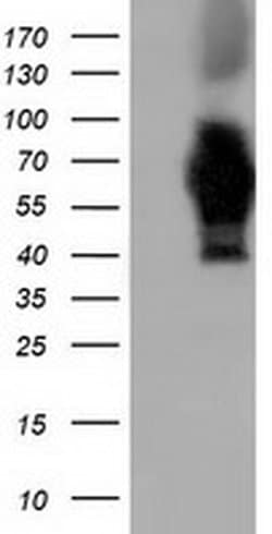 AK5 Monoclonal Antibody (OTI2F9), TrueMAB , OriGene 100 &mu;L; Unconjugated:Antibodies,