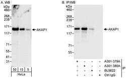 AKAP1 Rabbit anti-Human, Polyclonal, Bethyl Laboratories 100 &mu;L; Unconjugated:Antibodies,