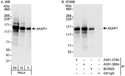 AKAP1 Rabbit anti-Human, Polyclonal, Bethyl Laboratories 100 &mu;L; Unconjugated:Antibodies,