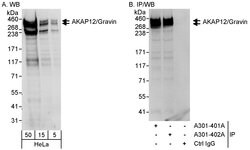 AKAP12/Gravin Rabbit anti-Human, Polyclonal, Bethyl Laboratories 100 &mu;L;