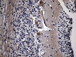 AKAP12 Mouse anti-Human, Clone: OTI1B6, lyophilized, TrueMAB 100 &mu;g;