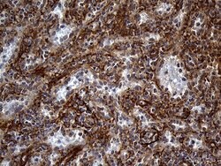 AKAP12 Mouse anti-Human, Clone: OTI1B6, lyophilized, TrueMAB 100 &mu;g;