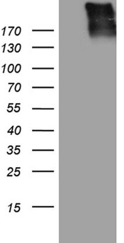 AKAP12 Mouse anti-Human, Clone: OTI1B6, lyophilized, TrueMAB 100 &mu;g;