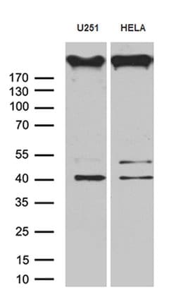 AKAP12 Mouse anti-Human, Clone: OTI1B6, lyophilized, TrueMAB 100 &mu;g;