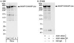 AKAP13/AKAP-Lbc Rabbit anti-Human, Polyclonal, Bethyl Laboratories 100
