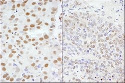 AKAP8/AKAP95 Rabbit anti-Human, Mouse, Polyclonal, Bethyl Laboratories