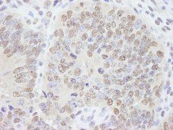 AKAP8/AKAP95 Polyclonal Antibody, Bethyl Laboratories 10 &mu;l; Unlabeled:Antibodies,