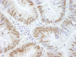 AKAP8/AKAP95 Polyclonal Antibody, Bethyl Laboratories 10 &mu;l; Unlabeled:Antibodies,
