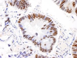 AKAP8L/HA95 Rabbit anti-Human, Polyclonal, Bethyl Laboratories 100 &mu;L;