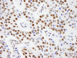 AKAP8L/HA95 Polyclonal Antibody, Bethyl Laboratories 10 &mu;L; Unconjugated:Antibodies,