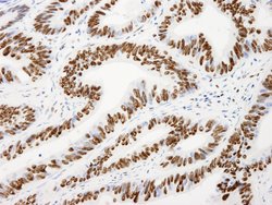 AKAP8L/HA95 Polyclonal Antibody, Bethyl Laboratories 10 &mu;L; Unconjugated:Antibodies,
