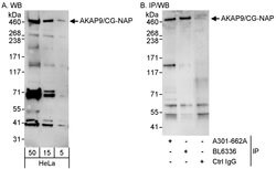 AKAP9/CG-NAP Rabbit anti-Human, Polyclonal, Bethyl Laboratories 100 &mu;l;
