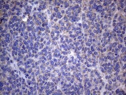 AKIP1 Monoclonal Antibody (OTI2E4), TrueMAB , OriGene 100 &mu;L; Unconjugated:Antibodies,