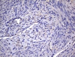 AKIP1 Monoclonal Antibody (OTI2E4), TrueMAB , OriGene 100 &mu;L; Unconjugated:Antibodies,