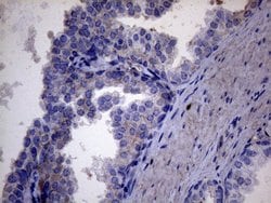 AKIP1 Monoclonal Antibody (OTI2E4), TrueMAB , OriGene 100 &mu;L; Unconjugated:Antibodies,