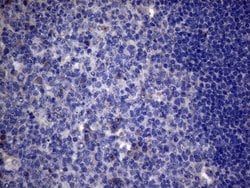 AKIP1 Monoclonal Antibody (OTI2E4), TrueMAB , OriGene 100 &mu;L; Unconjugated:Antibodies,