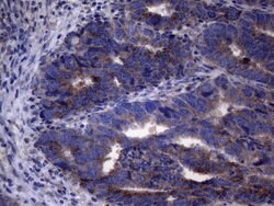 AKIP1 Monoclonal Antibody (OTI2E4), TrueMAB , OriGene 100 &mu;L; Unconjugated:Antibodies,