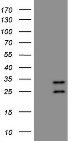 AKIP1 Monoclonal Antibody (OTI1E3), TrueMAB , OriGene 100 &mu;L | Buy Online | Origene Technologies | Fisher Scientific