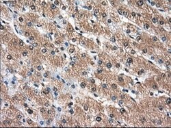 AKR1A1 Mouse anti-Human, Clone: OTI2E7, lyophilized, TrueMAB 100 &mu;g;