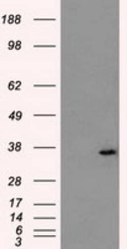 AKR1A1 Mouse anti-Human, Clone: OTI10E11, lyophilized, TrueMAB 100 &mu;g;