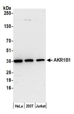 AKR1B1 Rabbit anti-Human, Polyclonal, Bethyl Laboratories 100 &mu;L; Unconjugated:Antibodies,