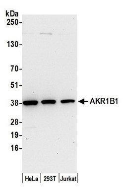 AKR1B1 Rabbit anti-Human, Polyclonal, Bethyl Laboratories 20 &mu;L; Unconjugated:Antibodies,