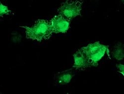 AKT1 Mouse anti-Canine, Human, Mouse, Rat, Clone: OTI4G4, lyophilized,