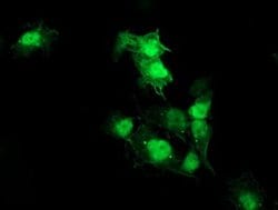 AKT1 Monoclonal Antibody (OTI2B9), TrueMAB , OriGene 100 &mu;L; Unconjugated:Antibodies,