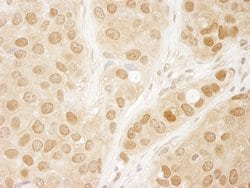 AKT1 Polyclonal Antibody, Bethyl Laboratories:Antibodies:Primary Antibodies