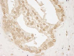 AKT1 Polyclonal Antibody, Bethyl Laboratories 100 &mu;L; Unconjugated:Antibodies,