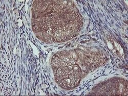 AKT1 Mouse anti-Canine, Human, Mouse, Rat, Clone: OTI4D6, lyophilized,