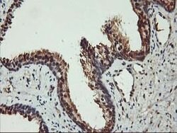 AKT1 Mouse anti-Canine, Human, Mouse, Rat, Clone: OTI4D6, lyophilized,